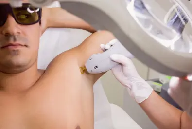 Erkeklere Özel Lazer Epilasyon